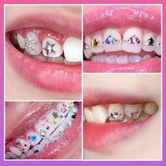 Diamond Tooth - Women Jewellery