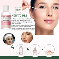Acne Cleansing Double Acid Serum Mild Edition