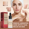 Anti-mole Potion Repair Smooth Skin Wart Care
