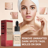 Anti-mole Potion Repair Smooth Skin Wart Care