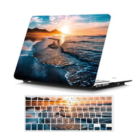 Suitable For MacBook , Customizable Painted Hard Shell