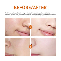 Turmeric Facial Mask Facial Care Hydrating