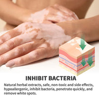 Repair Fade White Spots Melanin Hand And Foot Skin Moss Efficacy On Skin Neck Cream