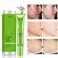 Meilin Anti-Acne Freckle Shrinking Pores And Tease Cream