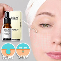 Via Recommends Bilin Lactobionic Acid Liquid Acne Cleansing Pore Live Hot
