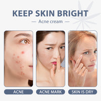 Repairing Moisturizing Whitening Fine Line Face Cream