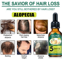 Eelhoe Ginger Hair Essential Oil. Eelhoe Ginger Hair Essential Oil