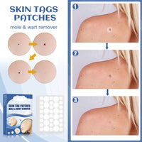 Ke Wart Patch Skin Mole Cleaning Care