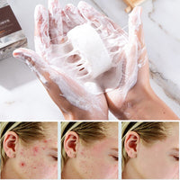 Goat's Milk Silk Foam Soap For Cleansing And Drawing And Anti-Mite Soap