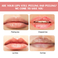 Watermelon Flavor Lip Balm Hydrating Freeze-dried Cracking