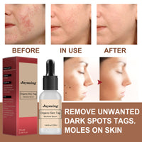 Anti-mole Potion Repair Smooth Skin Wart Care