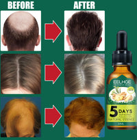 Eelhoe Ginger Hair Essential Oil. Eelhoe Ginger Hair Essential Oil