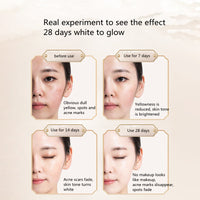 Moisturizing Moisturizing Diluted Spots Refined Pores Hydroquinone Serum
