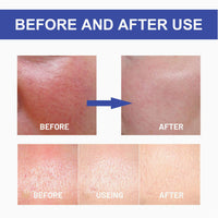 Hyaluronic Acid Sunscreen