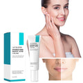 Desalting Pimple Moisturizing Delicate Skin Lightening Cream