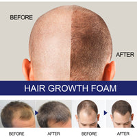 N Men's Dense Hair Foam Deep Repair Care