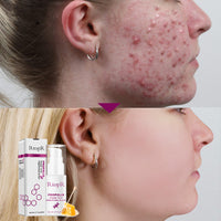 Light Licorice Pore Liquid Product AliExpress Supply