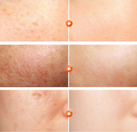 R·RASHEL Whitening Night Cream