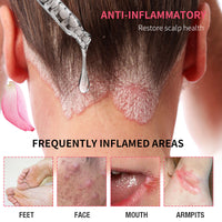 Spa Aromatherapy Soothing Facial Pain Relief Rose Essential Oil Massage Gua Sha Oil