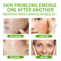 Facial Gel Cream Fade Spot Fine Lines