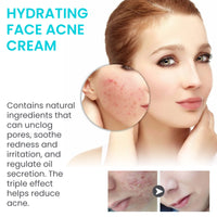 Desalting Pimple Moisturizing Delicate Skin Lightening Cream