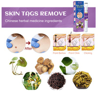 Removal Pen Fade Mole Removal Hand Foot Face