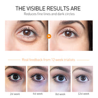 Moisturizing And Firming Eye Cream To Weaken Fine Lines And Dark Circles