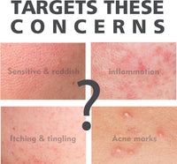 Salicylate Skin Repair Acne Skin Care Water