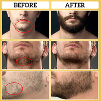 Men's Beard Oil Moisturizing