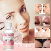 Acne Cleansing Double Acid Serum Mild Edition