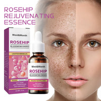 Rose Fruit Skin Rejuvenation Moisturizing Toner