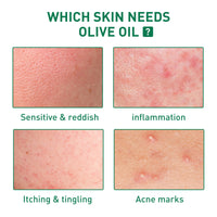 Tea Tree Oil Facial Skin Cleaning And Repair