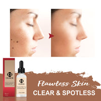 Mole Skin care lotion Repair Mole Black Spot Mole Mole Elimination Rose Essential Oil