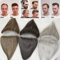 Hairline Wig Stickers Men's Bang Sticker Scalp Invisible Hair Supplementing Piece