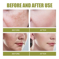 Fade Spot Repair Skin Dull Whitening Skin Lightening Cream