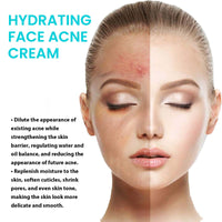 Desalting Pimple Moisturizing Delicate Skin Lightening Cream