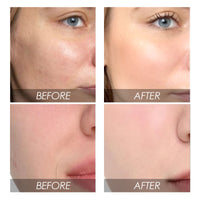 Avocado Watermelon Facial Fading Wrinkle Liquid