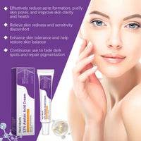 Azelaic Acid Repair Cream Desalting Pimple