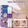 Removal Pen Fade Mole Removal Hand Foot Face